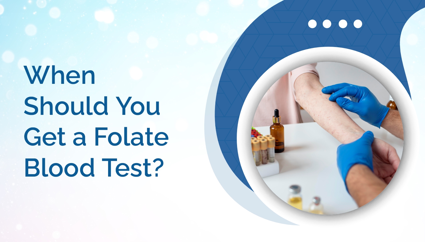 When Should You Get a Folate Blood Test?